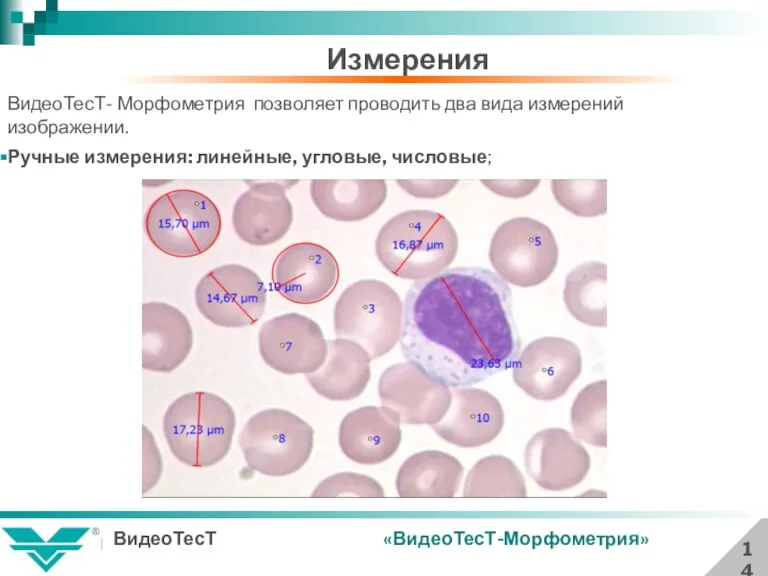 Измерения 14 «ВидеоТесТ-Морфометрия» ВидеоТесТ- Морфометрия позволяет проводить два вида измерений изображении. Ручные измерения: линейные, угловые, числовые;