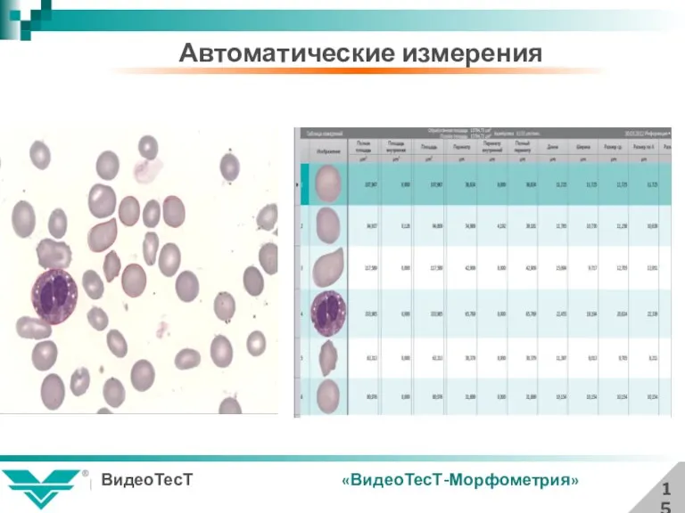 Автоматические измерения 15 «ВидеоТесТ-Морфометрия»