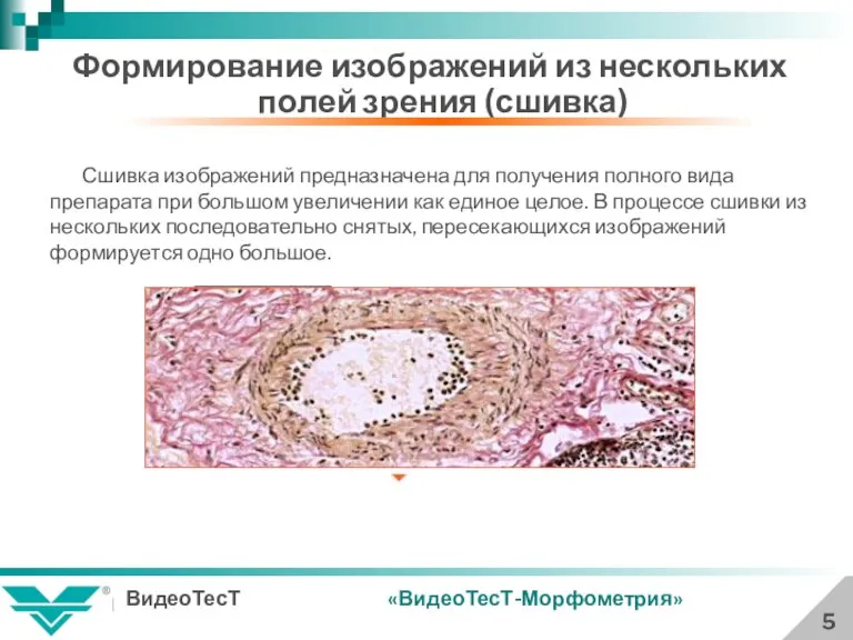 5 Формирование изображений из нескольких полей зрения (сшивка) Сшивка изображений предназначена для