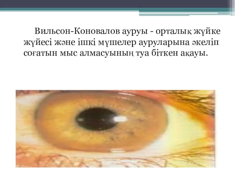 Вильсон-Коновалов ауруы - орталық жүйке жүйесі және ішкі мүшелер ауруларына әкеліп соғатын