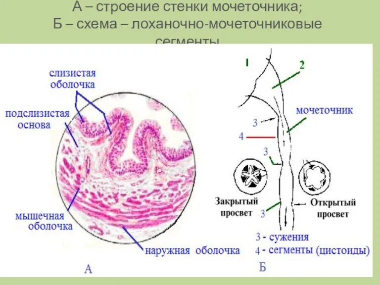 А – строение стенки мочеточника; Б – схема – лоханочно-мочеточниковые сегменты