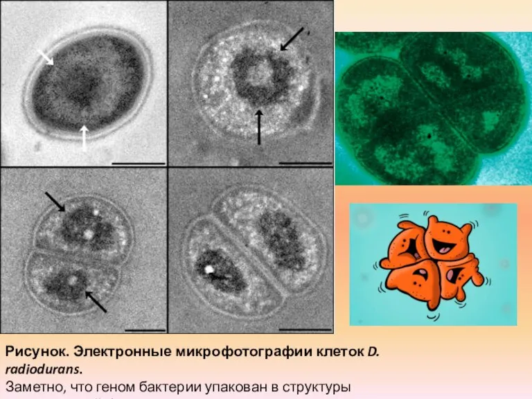 Рисунок. Электронные микрофотографии клеток D. radiodurans. Заметно, что геном бактерии упакован в структуры тороидальной формы.