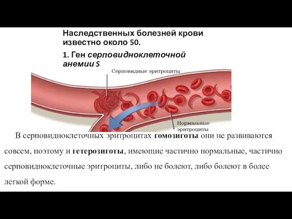 Наследственных болезней крови известно около 50. 1. Ген серповидноклеточной анемии S В