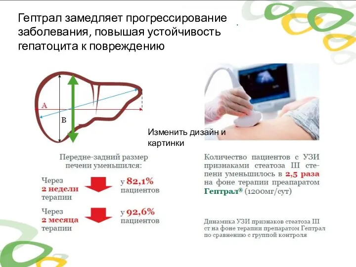 Гептрал замедляет прогрессирование заболевания, повышая устойчивость гепатоцита к повреждению Изменить дизайн и картинки