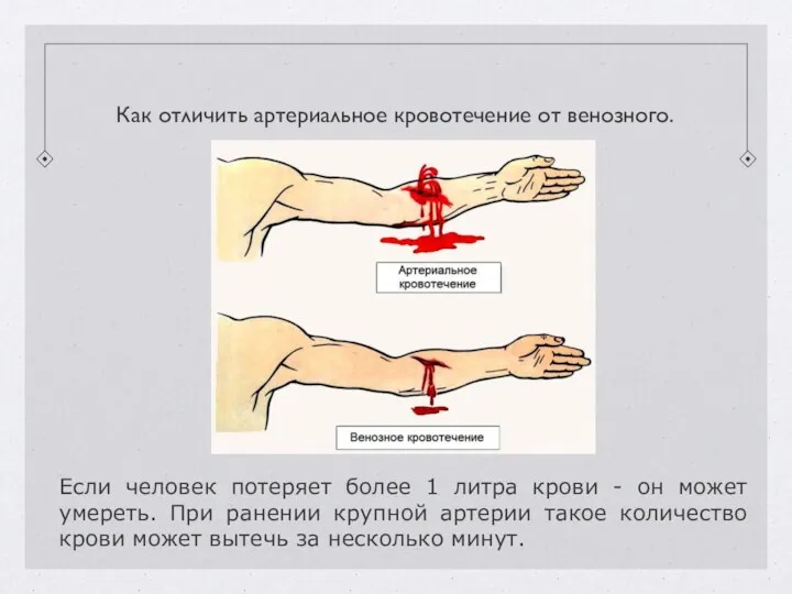 Если человек потеряет более 1 литра крови - он может умереть. При