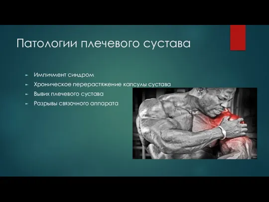 Патологии плечевого сустава Импичмент синдром Хроническое перерастяжение капсулы сустава Вывих плечевого сустава Разрывы связочного аппарата