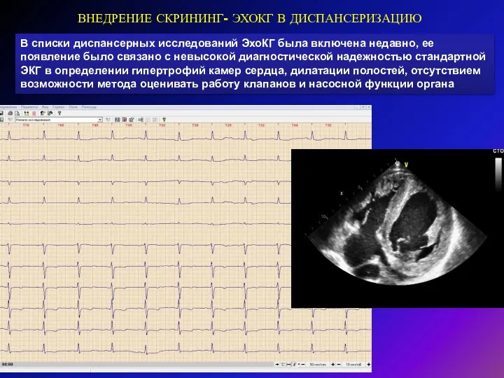 ВНЕДРЕНИЕ СКРИНИНГ- ЭХОКГ В ДИСПАНСЕРИЗАЦИЮ В списки диспансерных исследований ЭхоКГ была включена