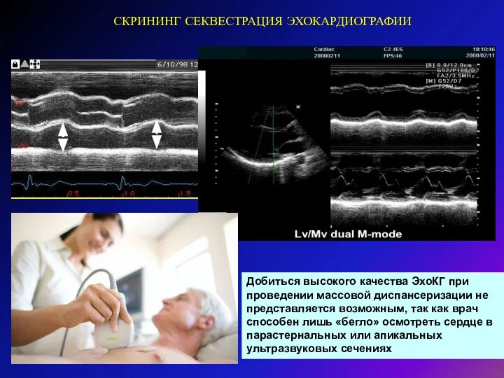 Добиться высокого качества ЭхоКГ при проведении массовой диспансеризации не представляется возможным, так