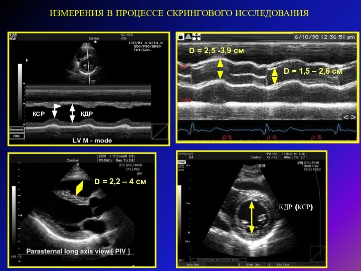 ИЗМЕРЕНИЯ В ПРОЦЕССЕ СКРИНГОВОГО ИССЛЕДОВАНИЯ