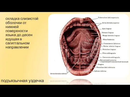 складка слизистой оболочки от нижней поверхности языка до десен идущая в сагиттальном направлении подъязычная уздечка