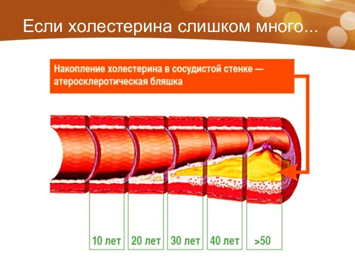 Если холестерина слишком много...