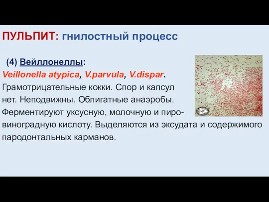 ПУЛЬПИТ: гнилостный процесс (4) Вейллонеллы: Veillonella аtypica, V.parvula, V.dispar. Грамотрицательные кокки. Спор
