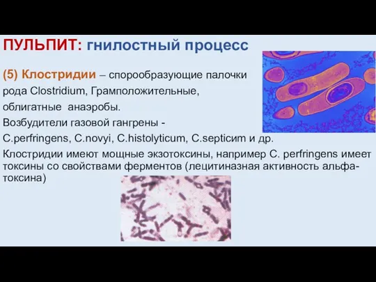 ПУЛЬПИТ: гнилостный процесс (5) Клостридии – спорообразующие палочки рода Clostridium, Грамположительные, облигатные