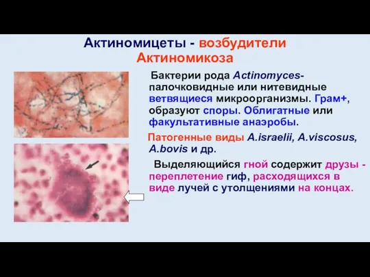 Актиномицеты - возбудители Актиномикоза Бактерии рода Actinomyces- палочковидные или нитевидные ветвящиеся микроорганизмы.