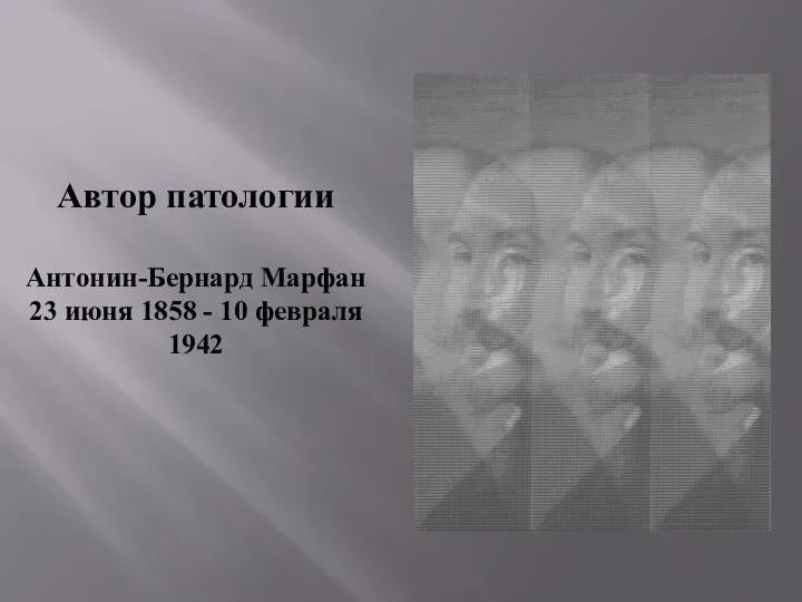 Автор патологии Антонин-Бернард Марфан 23 июня 1858 - 10 февраля 1942