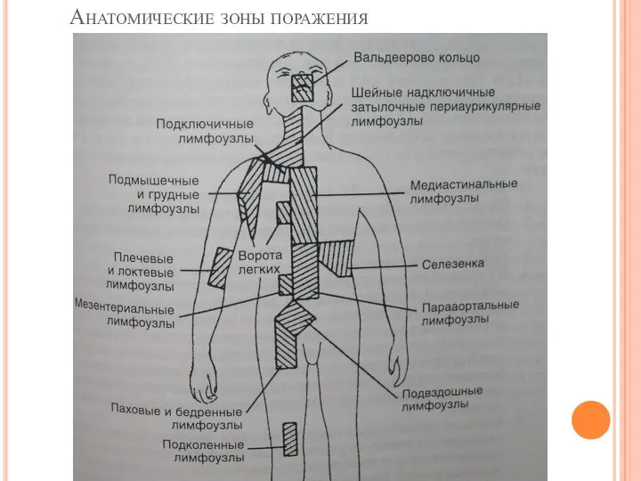 Анатомические зоны поражения