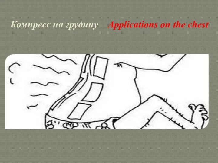 Компресс на грудину Applications on the chest