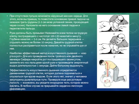 При отсутствии пульса начинайте наружный массаж сердца. Для этого, если вы правша,