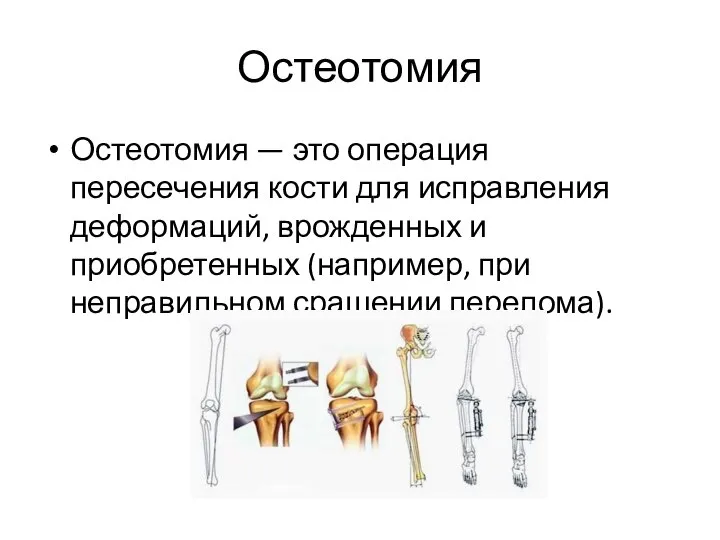 Остеотомия Остеотомия — это операция пересечения кости для исправления деформаций, врожденных и