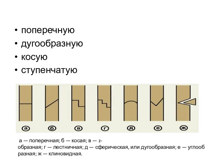 поперечную дугообразную косую ступенчатую а — поперечная; б — косая; в —