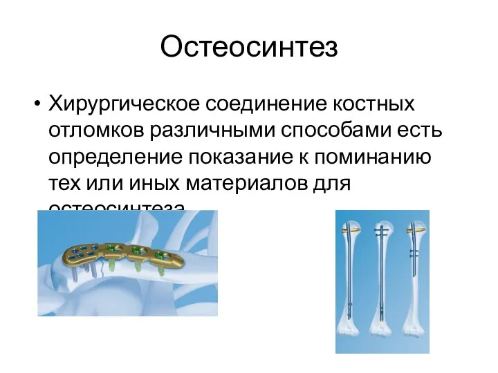 Остеосинтез Хирургическое соединение костных отломков различными способами есть определение показание к поминанию