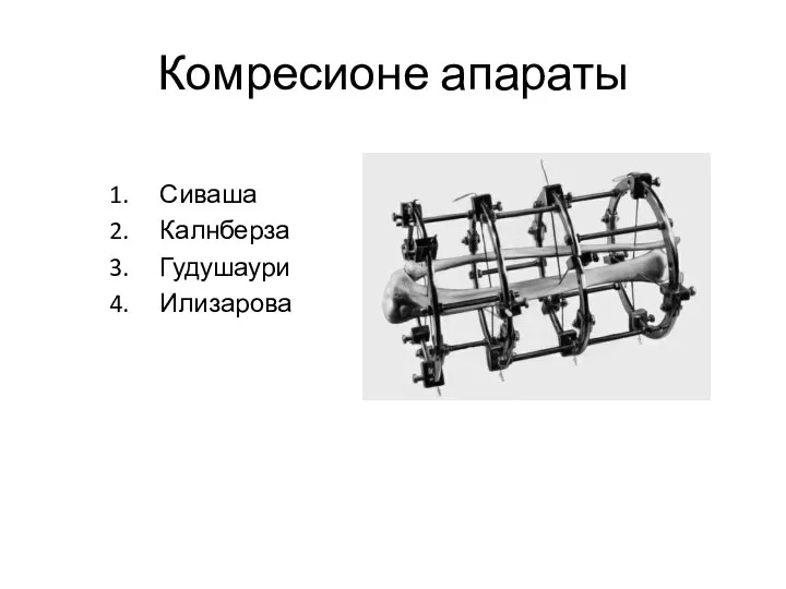 Комресионе апараты Сиваша Калнберза Гудушаури Илизарова