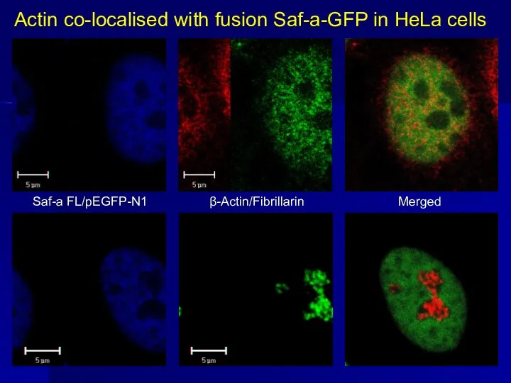 Actin co-localised with fusion Saf-a-GFP in HeLa cells Saf-a FL/pEGFP-N1 β-Actin/Fibrillarin Merged