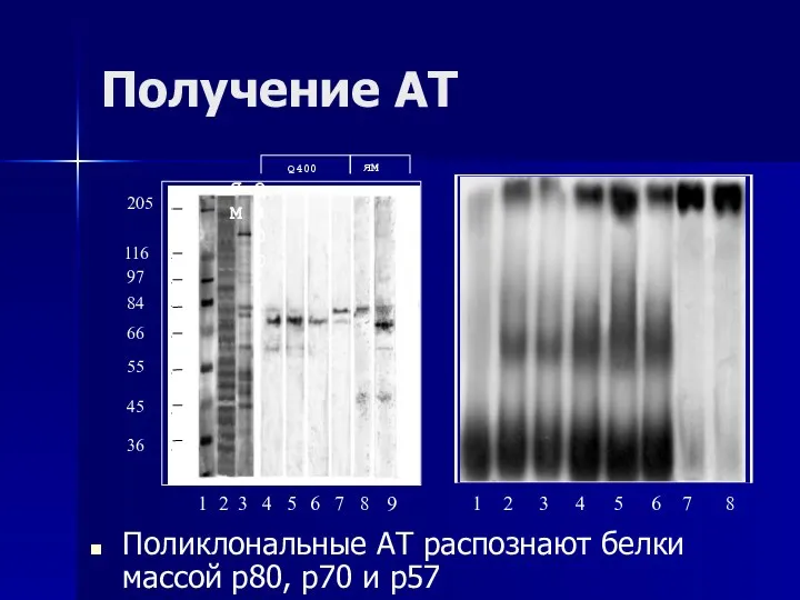 Получение АТ Поликлональные АТ распознают белки массой р80, р70 и р57