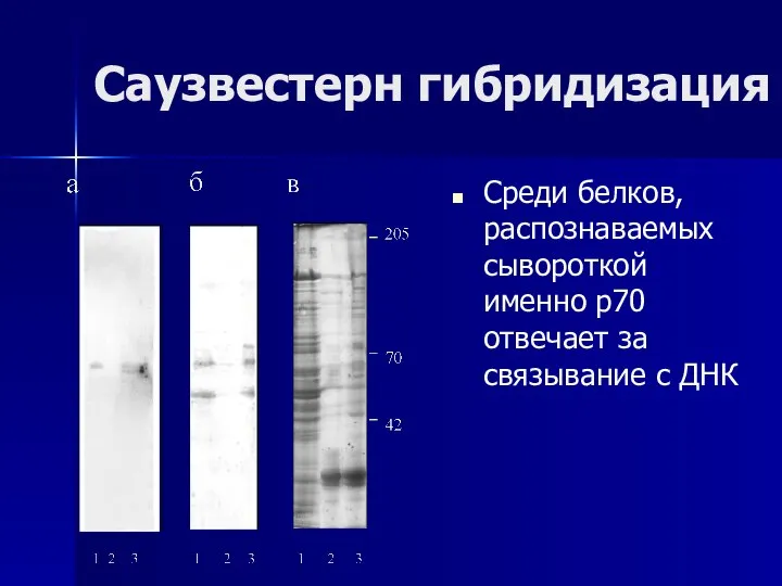 Саузвестерн гибридизация Среди белков, распознаваемых сывороткой именно р70 отвечает за связывание с ДНК
