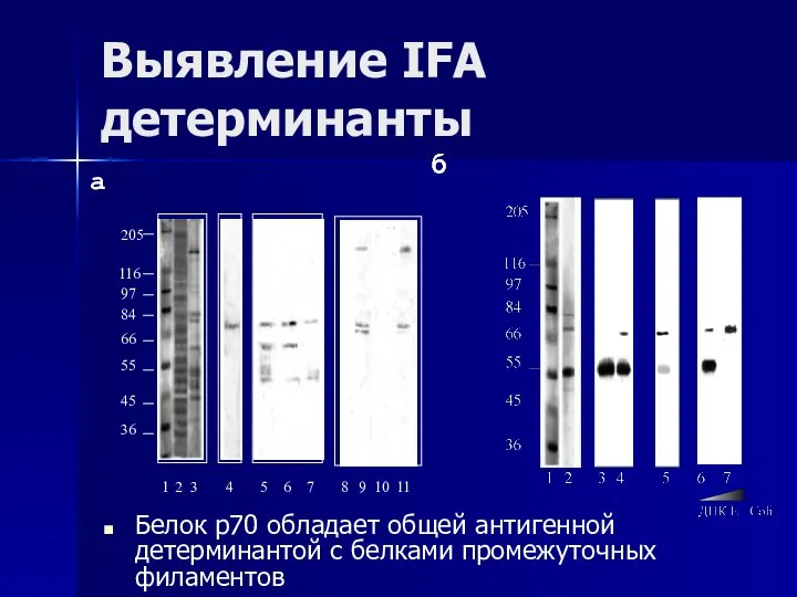 Выявление IFA детерминанты Белок р70 обладает общей антигенной детерминантой с белками промежуточных