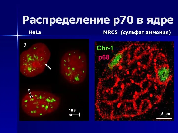 Распределение р70 в ядре HeLa MRC5 (сульфат аммония)