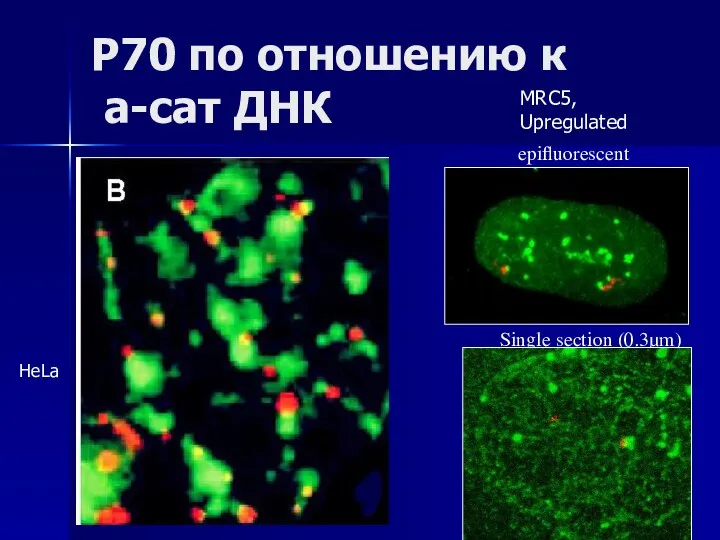 P70 по отношению к а-сат ДНК MRC5, Upregulated Single section (0.3μm) epifluorescent HeLa