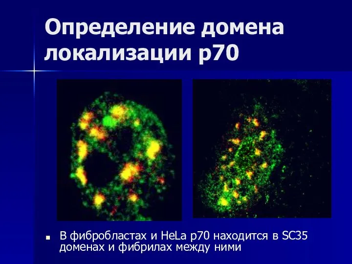 Определение домена локализации р70 В фибробластах и HeLa р70 находится в SC35