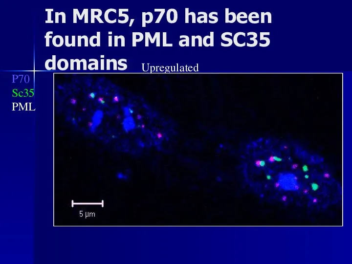 P70 Sc35 PML In MRC5, p70 has been found in PML and SC35 domains Upregulated