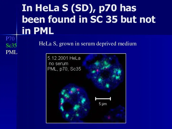 P70 Sc35 PML In HeLa S (SD), p70 has been found in