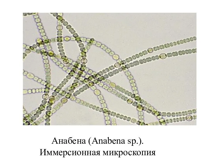 Анабена (Anabena sp.). Иммерсионная микроскопия