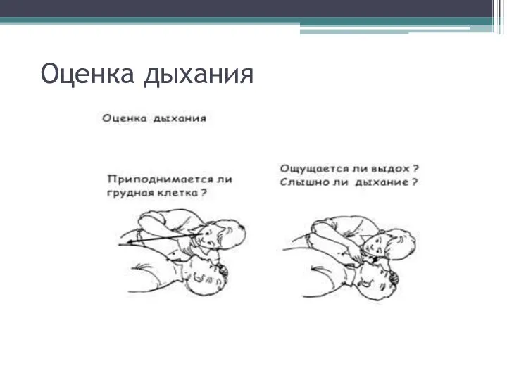 Оценка дыхания