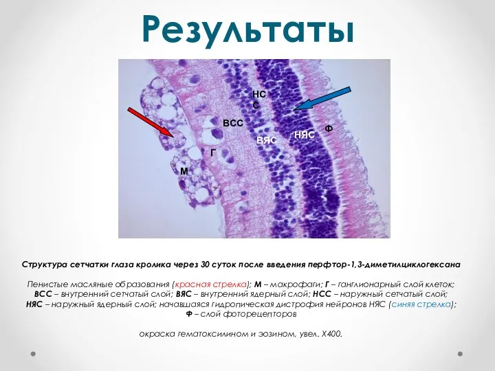 Результаты Ф ВСС ВЯС НЯС Г НСС М Структура сетчатки глаза кролика