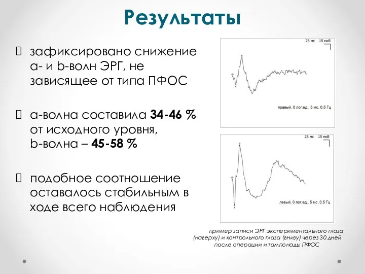 Результаты зафиксировано снижение а- и b-волн ЭРГ, не зависящее от типа ПФОС