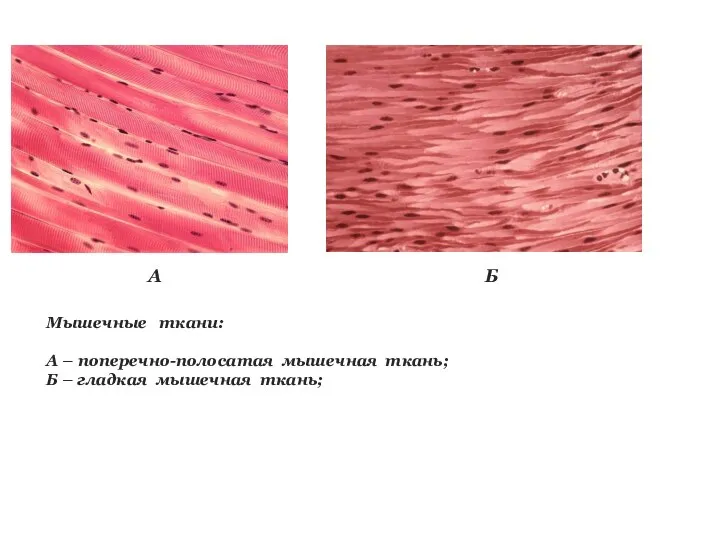 Мышечные ткани: А – поперечно-полосатая мышечная ткань; Б – гладкая мышечная ткань; А Б