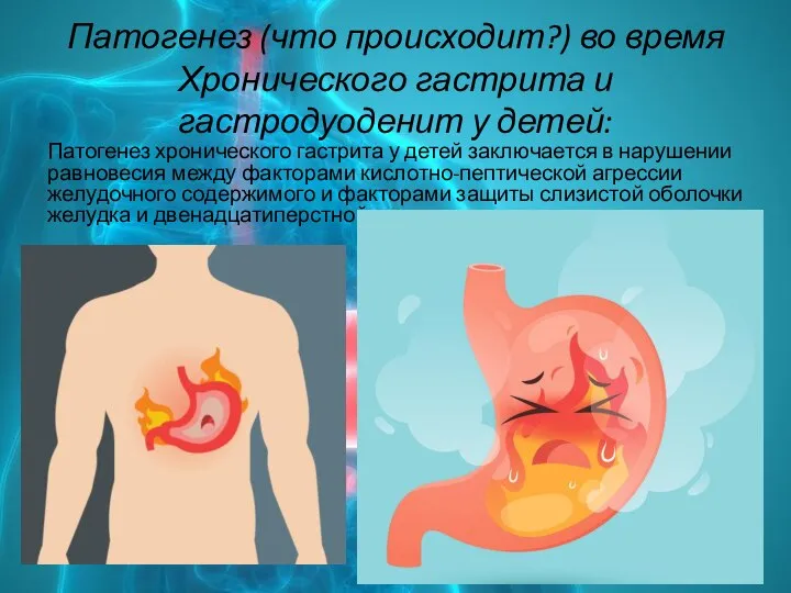 Патогенез (что происходит?) во время Хронического гастрита и гастродуоденит у детей: Патогенез