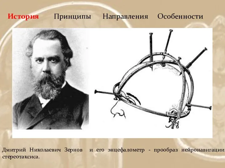 История Принципы Направления Особенности Дмитрий Николаевич Зернов и его энцефалометр - прообраз нейронавигации и стереотаксиса.