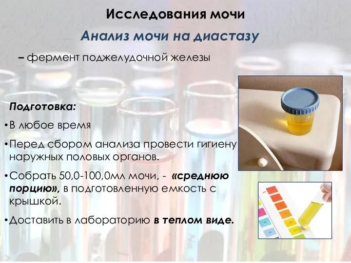 Исследования мочи Подготовка: В любое время Перед сбором анализа провести гигиену наружных