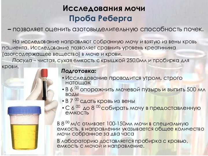 Исследования мочи Подготовка: Исследование проводится утром, строго натощак В 6 00 опорожнить