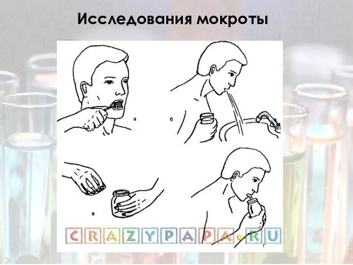 Исследования мокроты