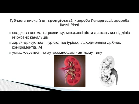 спадкова аномалія розвитку: множинні кісти дистальних відділів ниркових канальців характеризується піурією, поліурією,