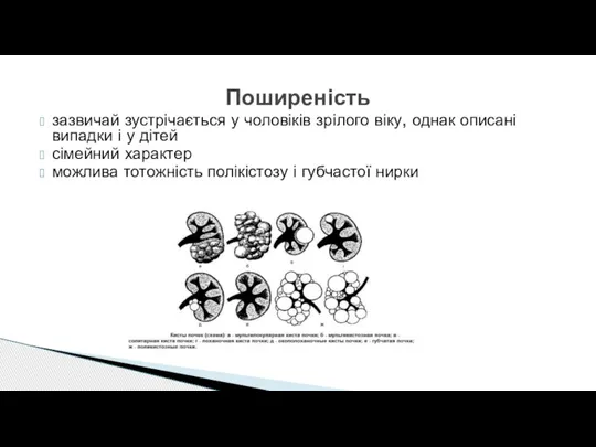 зазвичай зустрічається у чоловіків зрілого віку, однак описані випадки і у дітей