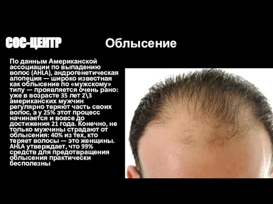 СОС-ЦЕНТР Облысение По данным Американской ассоциации по выпадению волос (AHLA), андрогенетическая алопеция