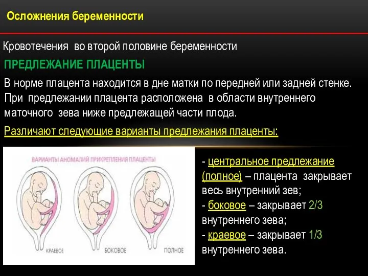 Осложнения беременности Кровотечения во второй половине беременности ПРЕДЛЕЖАНИЕ ПЛАЦЕНТЫ В норме плацента
