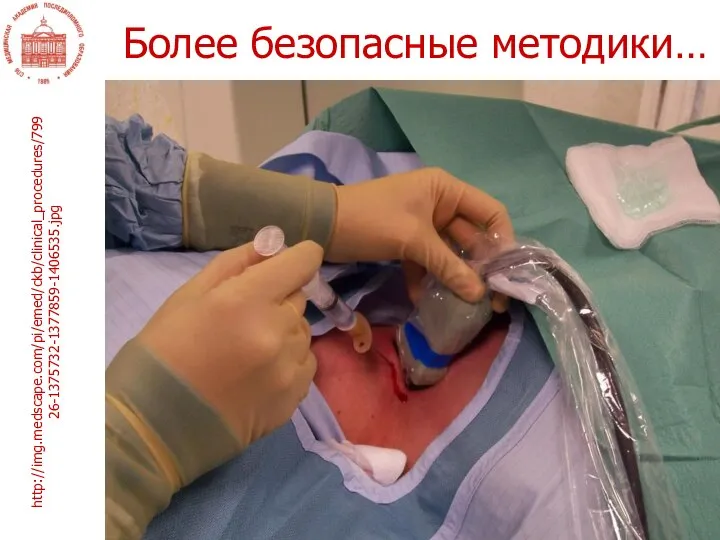 Более безопасные методики… http://img.medscape.com/pi/emed/ckb/clinical_procedures/79926-1375732-1377859-1406535.jpg